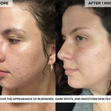 BEAUTY POPS™ Glow Enzyme Frozen Mask (MASK ONLY)