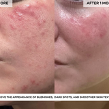 BEAUTY POPS™ Glow Enzyme Frozen Mask (MASK ONLY)