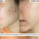 BEAUTY POPS™ Glow Enzyme Frozen Mask (MASK ONLY)